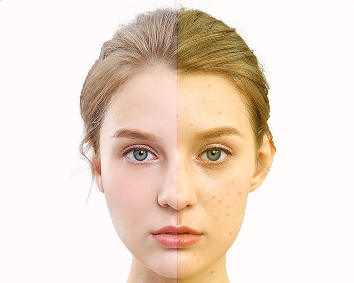 7-Color LED Face Mask – Light Therapy for Glowing Skin